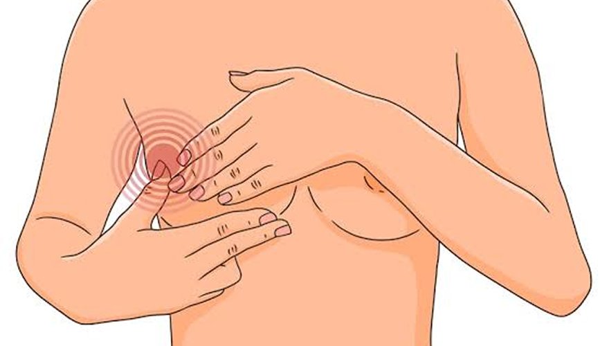 Breast Lump Surgery