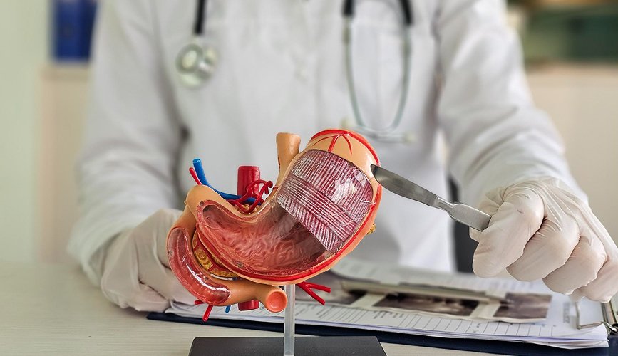 Gastrointestinal Surgery