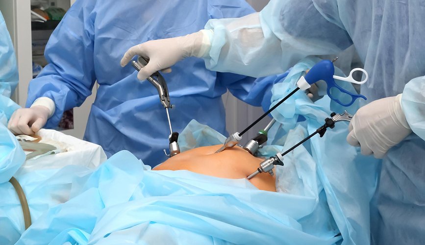 Laparoscopic Surgery