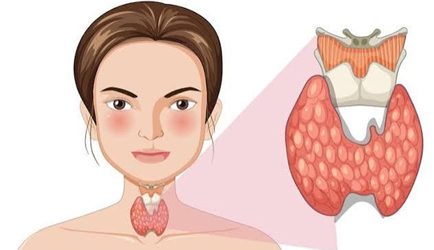 Thyroid Surgery