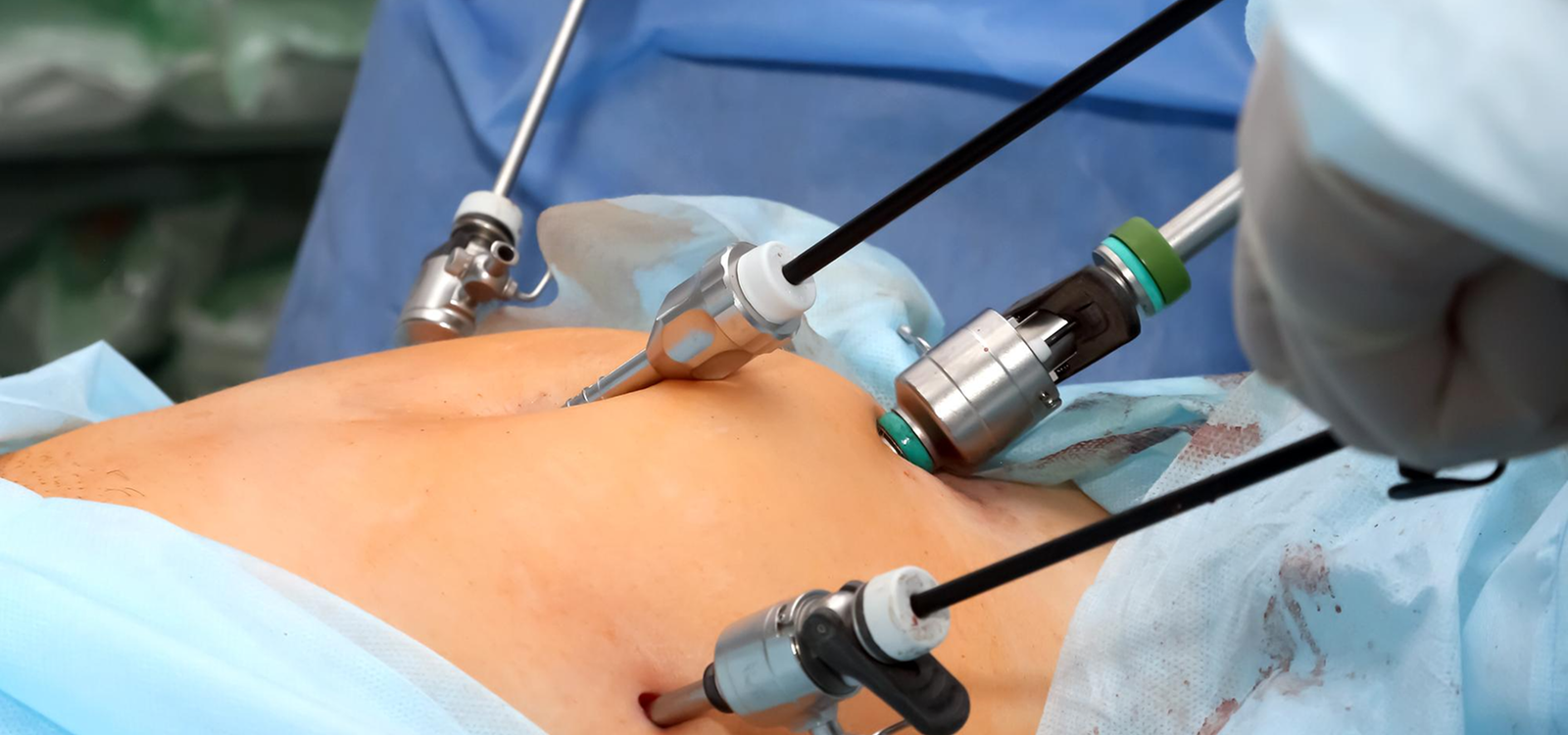 Featured surgical care