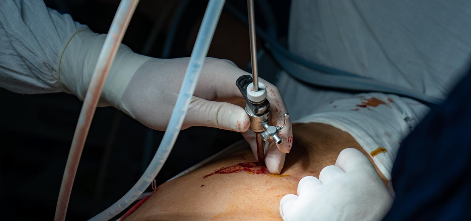 Featured surgical care