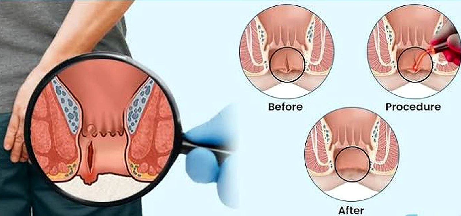 Featured surgical care